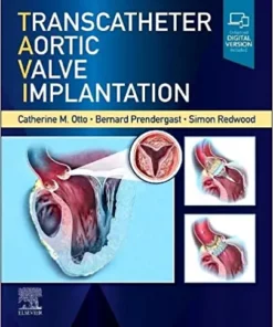 Transcatheter Aortic Valve Implantation (Original PDF from Publisher)