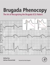 Brugada Phenocopy : The Art of Recognizing the Brugada ECG Pattern (PDF) 2018