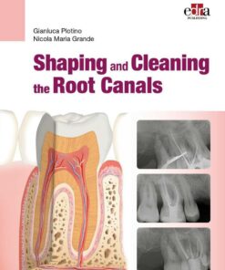 SHAPING AND CLEANING THE ROOT CANALS 2023