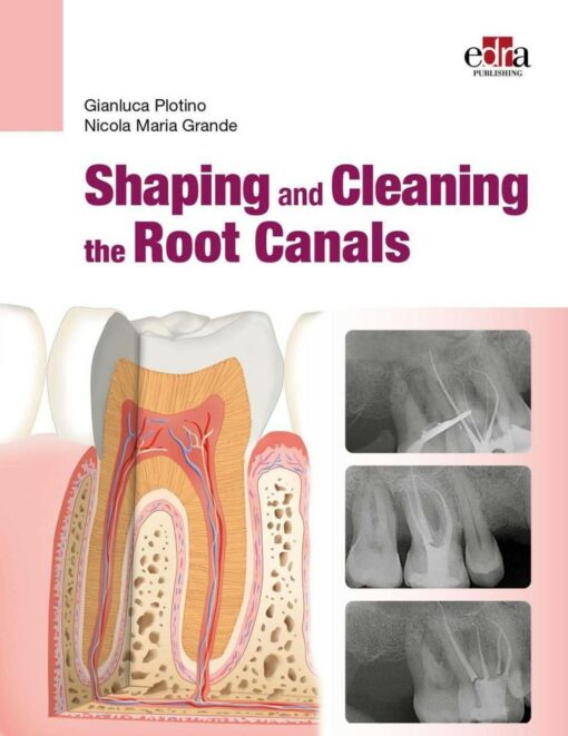 SHAPING AND CLEANING THE ROOT CANALS 2023