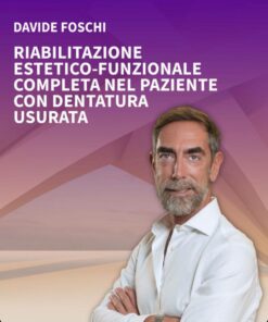Riabilitazione Estetico-Funzionale Completa Nel Paziente Con Dentatura Usurata