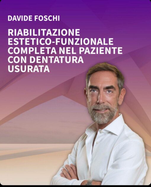 Riabilitazione Estetico-Funzionale Completa Nel Paziente Con Dentatura Usurata