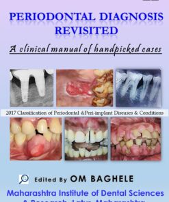 Periodontal Diagnosis Revisited: A Clinical Manual of Handpicked Cases PDF Convent