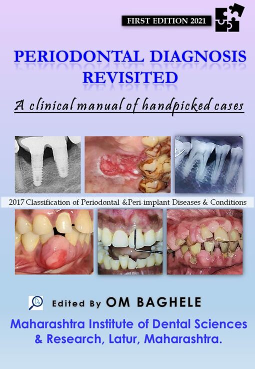 Periodontal Diagnosis Revisited: A Clinical Manual of Handpicked Cases PDF Convent