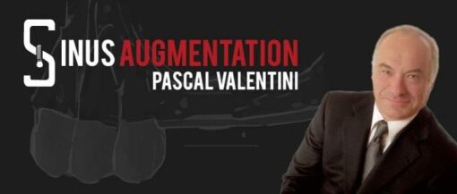 Osteocom Sinus Augmentation International