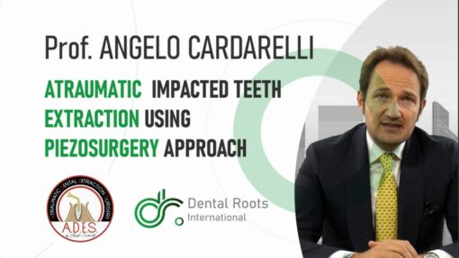 Piezosurgery Approach for Impacted Teeth Extraction - Angelo Cardarelli