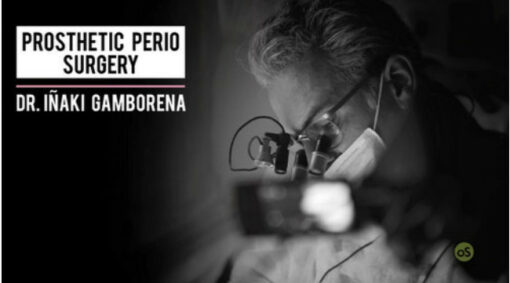 Prosthetic Perio Surgery (video course)
