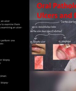 Ulcers and biopsy
