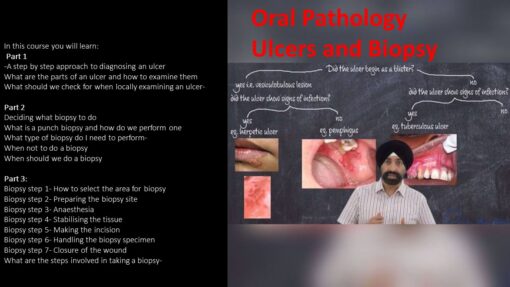 Ulcers and biopsy