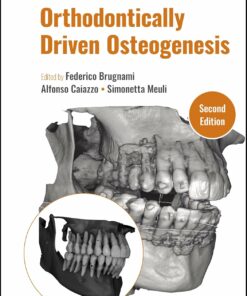Orthodontically Driven Osteogenesis 2nd Edition PDF 