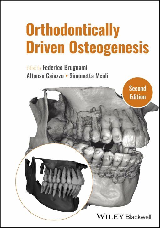 Orthodontically Driven Osteogenesis 2nd Edition PDF 