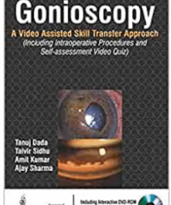 Gonioscopy:A Video Assisted Skill Transfer Approach (Videos Only)