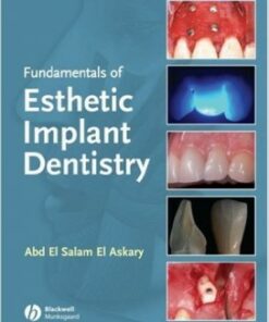 Fundamentals of Esthetic Dentistry, Second Edition 2nd Edition