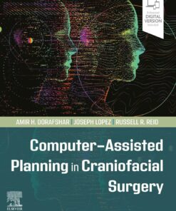 Computer-Assisted Planning in Craniofacial Surgery PDF 