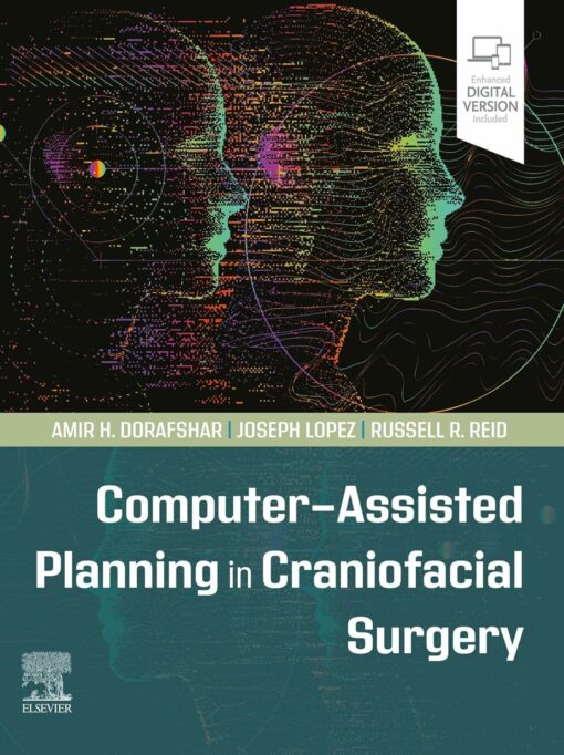 Computer-Assisted Planning in Craniofacial Surgery PDF 