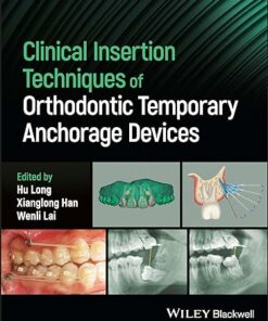 Clinical Insertion Techniques of Orthodontic Temporary Anchorage Devices (Original PDF from Publisher)