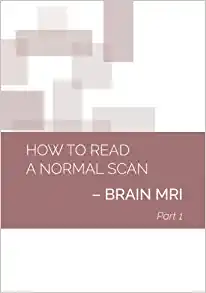 How to Read a Normal Scan: BRAIN MRI PART 1 (High Quality Image PDF)
