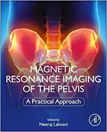 Magnetic Resonance Imaging of The Pelvis: A Practical Approach (Original PDF from Publisher)