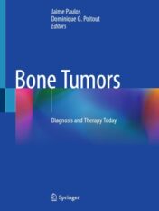 Bone Tumors Diagnosis and Therapy Today 2021 Original pdf
