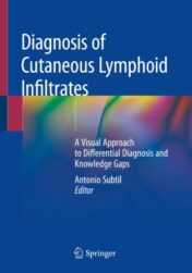 Diagnosis of Cutaneous Lymphoid Infiltrates A Visual Approach to Differential Diagnosis and Knowledge Gaps 2019 ORIGINAL PDF