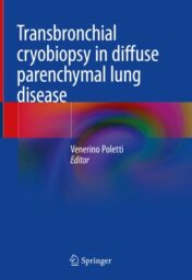 Transbronchial cryobiopsy in diffuse parenchymal lung disease 2019 ORIGINAL PDF