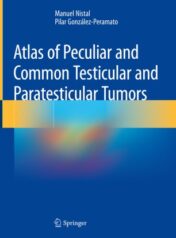 Atlas of Peculiar and Common Testicular and Paratesticular Tumors 2020 ORIGINAL PDF