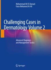 Challenging Cases in Dermatology Volume 2 Advanced Diagnoses and Management Tactics 2019 ORIGINAL PDF