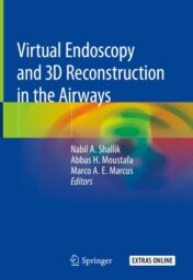 Virtual Endoscopy and 3D Reconstruction in the Airways 2019 ORIGINAL PDF