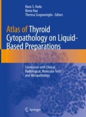 Atlas of Thyroid Cytopathology on Liquid-Based Preparations Correlation with Clinical, Radiological, Molecular Tests and Histopathology 2020 Original pdf