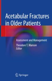 Acetabular Fractures in Older Patients Assessment and Management Editors (view affiliations) 2020 Original pdf