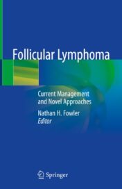 Follicular Lymphoma Current Management and Novel Approaches Original PDF 2020