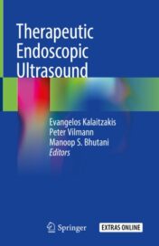 Therapeutic Endoscopic Ultrasound 2020 ORIGINAL PDF