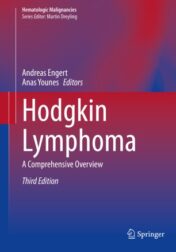 Hodgkin Lymphoma A Comprehensive Overview 2020 ORIGINAL PDF