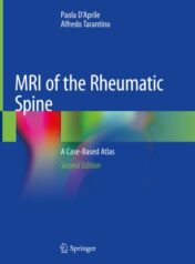 MRI of the Rheumatic Spine A Case-Based Atlas 2020 Original pdf