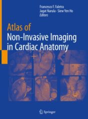 Atlas of Non-Invasive Imaging in Cardiac Anatomy 2020 ORIGINAL PDF