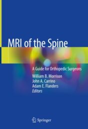 MRI of the Spine A Guide for Orthopedic Surgeons 2020 Original pdf