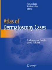 Atlas of Dermatoscopy Cases Challenging and Complex Clinical Scenarios 2020 ORIGINAL PDF