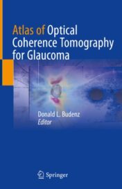 Atlas of Optical Coherence Tomography for Glaucoma 2020 Original pdf
