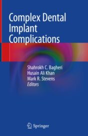 Complex Dental Implant Complications 2020 Original pdf