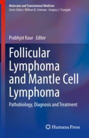 Follicular Lymphoma and Mantle Cell Lymphoma Original PDF 2020