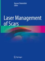 Laser Management of Scars 2020 ORIGINAL PDF