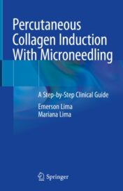 Percutaneous Collagen Induction With Microneedling A Step-by-Step Clinical Guide 2021 ORIGINAL PDF