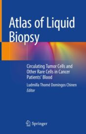 Atlas of Liquid Biopsy Circulating Tumor Cells and Other Rare Cells in Cancer Patients’ Blood 2021 Original pdf