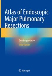 Atlas of Endoscopic Major Pulmonary Resections  Original pdf