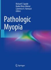Pathologic Myopia 2021 Original pdf