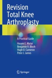 Revision Total Knee Arthroplasty A Practical Guide  Original pdf