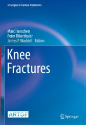 2022 Knee Fractures (Strategies in Fracture Treatments) 2021 Original PDF