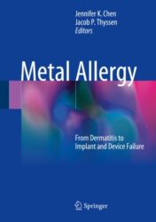 Metal Allergy From Dermatitis to Implant and Device Failure 2018 ORIGINAL PDF