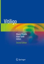 Vitiligo 2019 ORIGINAL PDF