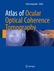 Atlas of Ocular Optical Coherence Tomography 2018 ORIGINAL PDF